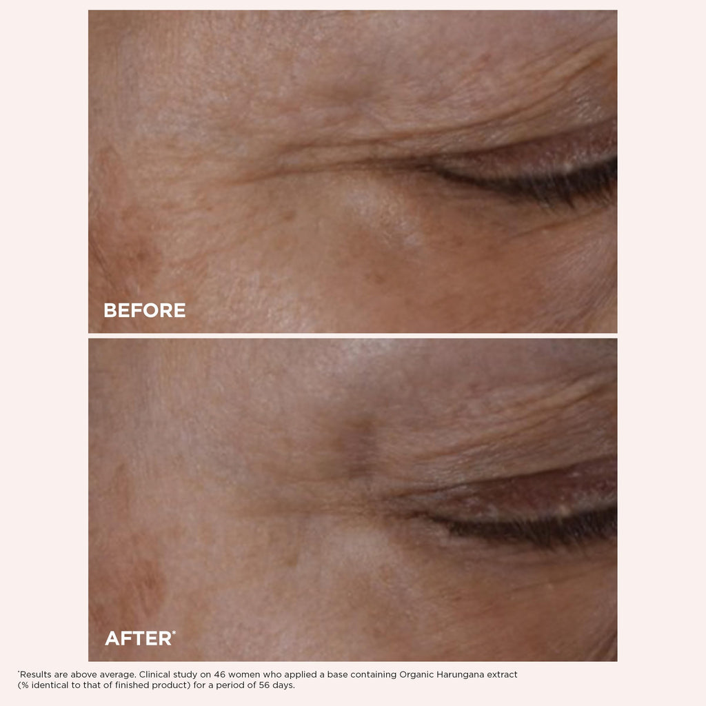 Clarins Total Eye Lift | Anti Aging Eye Cream | Targets Wrinkles, Crow's Feet, Dark Circles and Puffiness For a Visible Eye Lift in 30 Seconds