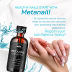 LIVORKA (2 Pack) Metanail Toenail Liquid, Metanail, Metanail Bottle, Meta Nail, Metanail Drops for Nails, Meta Nail Liquid, Metanail Nail 2 Bottles