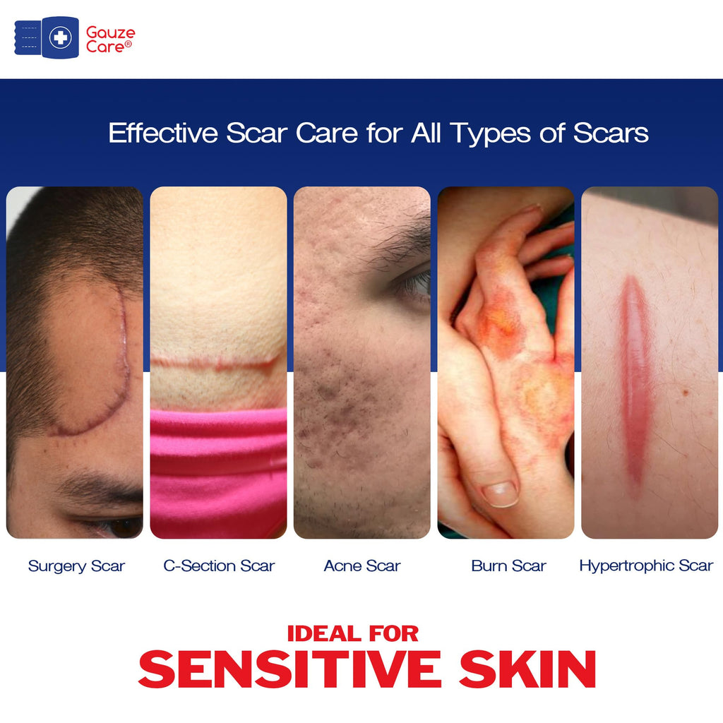 GauzeCare Silicone Scar Tape – 1.6”x150” Roll – Medical-Grade, Reusable, Professional Silicone Scar Tape for surgical scars, C-Section, Burns, Keloid, and Acne Scars