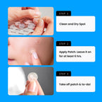 AVARELLE Pimple Patches for Face | Hydrocolloid Acne Patches for Covering Blemishes | FSA HSA Store Eligible Zit Patches with Tea Tree, Calendula, & Cica | (10-14 mm, 300 Count) Bulk Pack