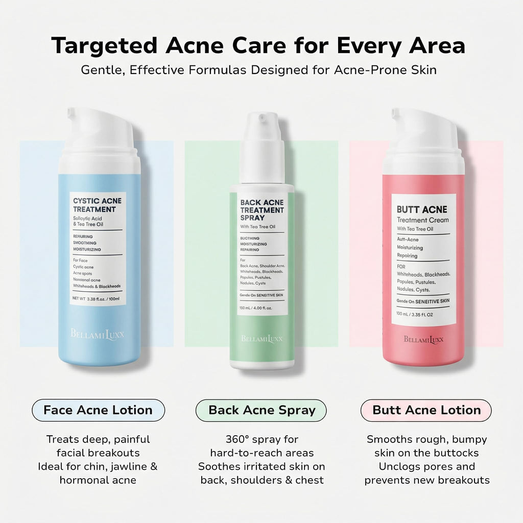 BellamiLuxx Fungal Acne Treatment Lotion: Effective Face & Body Pimple Cream for Bumps, Clusters, Itch & Redness – Fungal Prone Skin Acne Treatment Moisturizer for Teens & Adults with Natural Actives