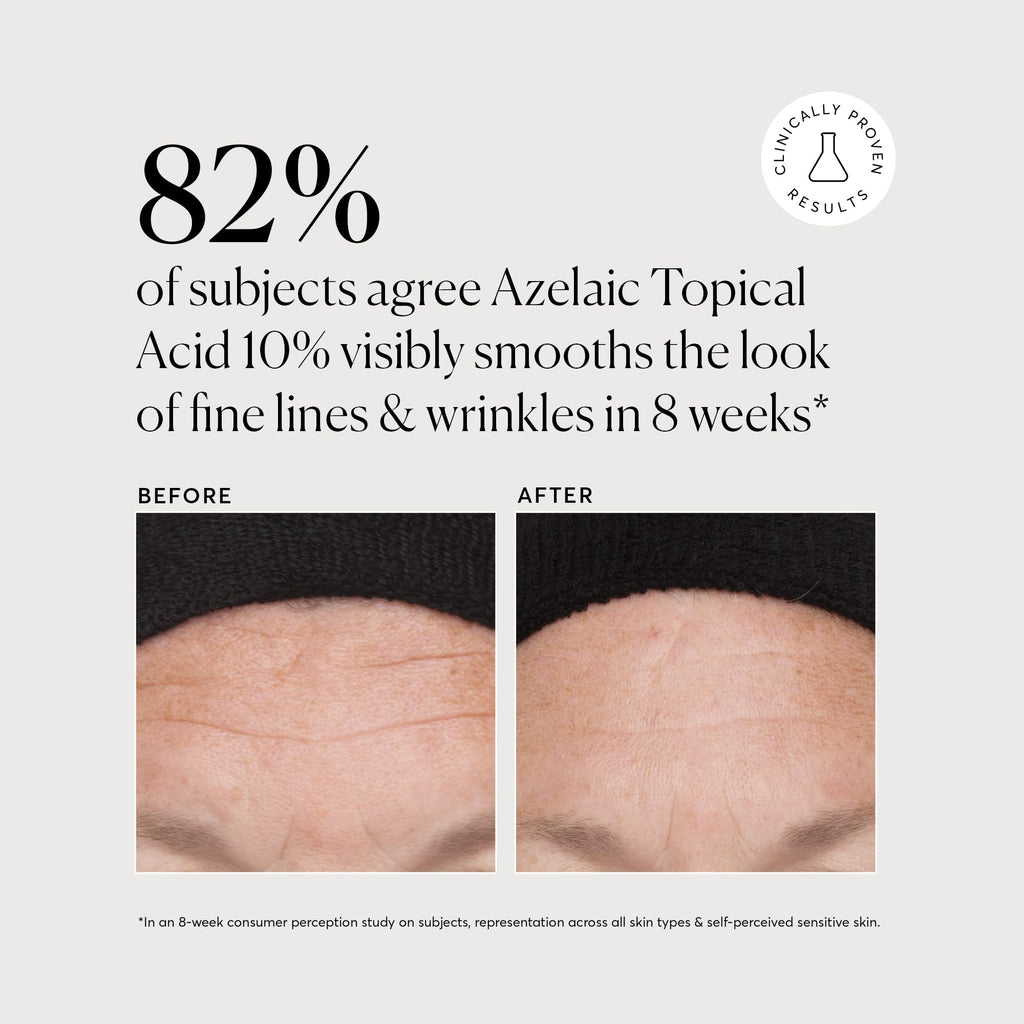 Naturium Azelaic Topical Acid 10%, Face & Skin Care Beauty Treatment with Niacinamide & Vitamin C, 1 oz