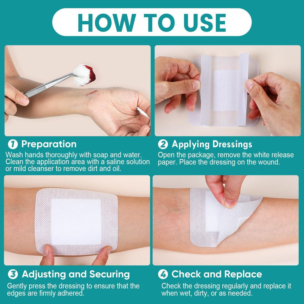 50 Count Island Dressing Bordered Gauze 4" x 4", Gauze Pads Individually Wrapped, Non-Stick Pad in Center with Adhesive Border, Bandages for Wounds, First Aid