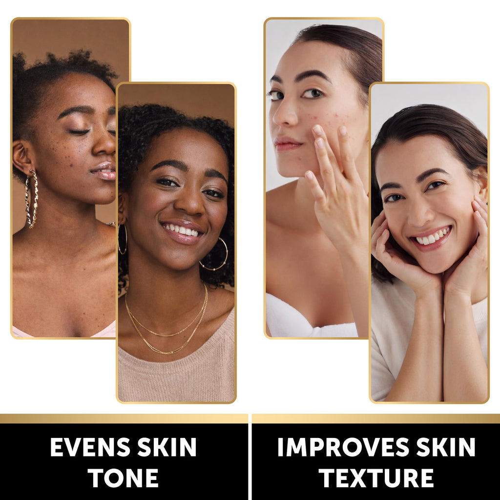 VALITIC Brightening Lemon & Turmeric Kojic Acid Soap, Vitamin C, Retinol - Original Japanese Complex with Hyaluronic Acid, Vitamin E, Shea Butter, Castile Olive Oil - 3 Pack Bundle with African Net