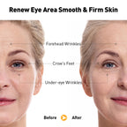 Retinol Eye Cream for Anti-Aging & Wrinkles – Firming, Hydrating & Repairing Eye Serum with Niacinamide, Hyaluronic Acid, Vitamin E & Bifida Ferment Lysate, 0.7 Fl Oz (Pack of 2)