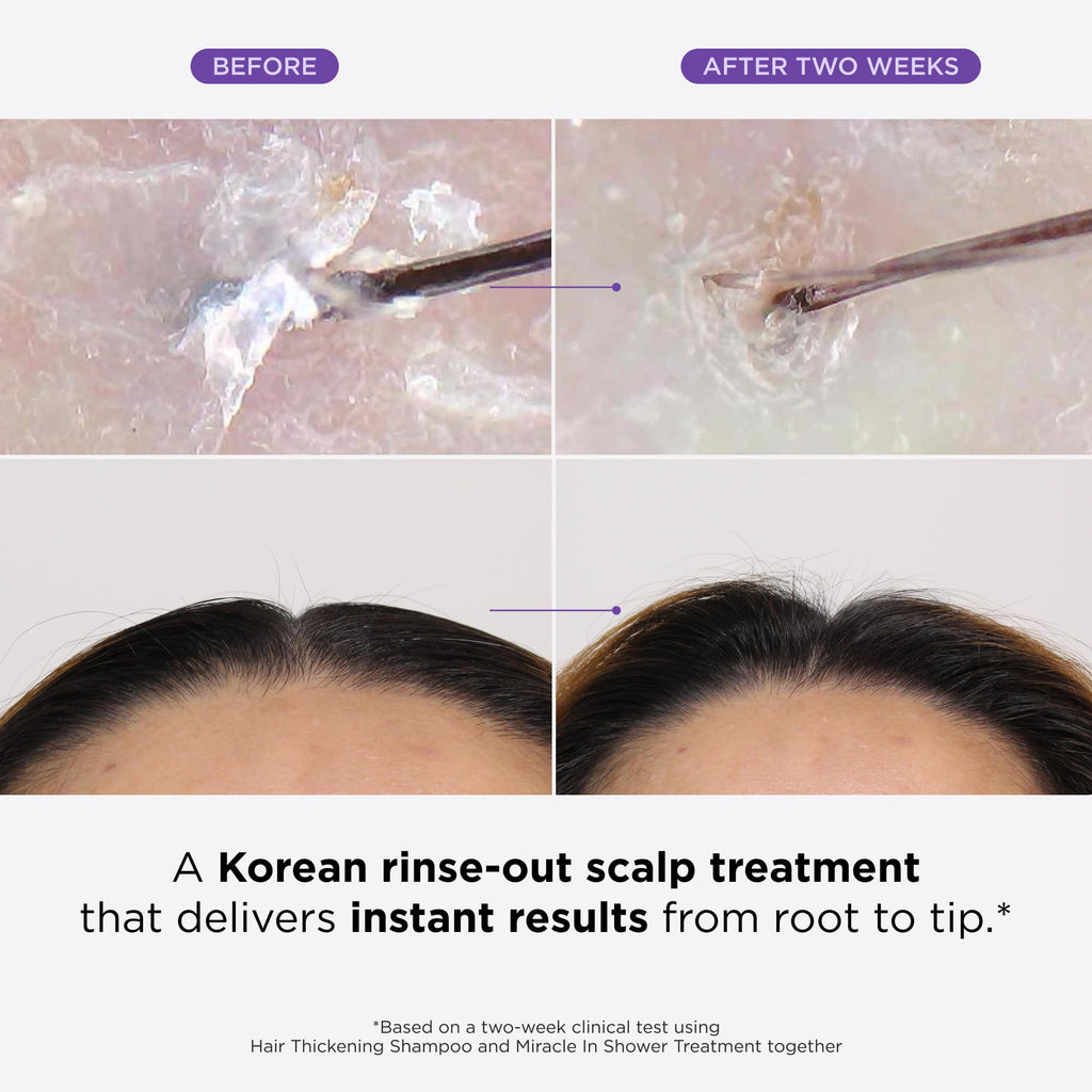Dr. Groot Miracle in Shower Treatment for Hair Loss - Korean Care 5-Second Smoothing Solution With Rosemary Oil, Moisturizing Scalp Revitalizing Rinse