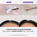 Dr. Groot Miracle in Shower Treatment for Hair Loss - Korean Care 5-Second Smoothing Solution With Rosemary Oil, Moisturizing Scalp Revitalizing Rinse