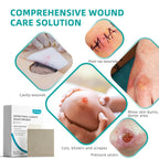 Dimora Upgrade Silver Calcium Alginate Wound Dressing -Antibacterial Non Stick Gauze for Wounds Care, Highly Absorbent Sterile Bandage Pads with Ag, 2'' x 2'' Patches 12 Packs Individual