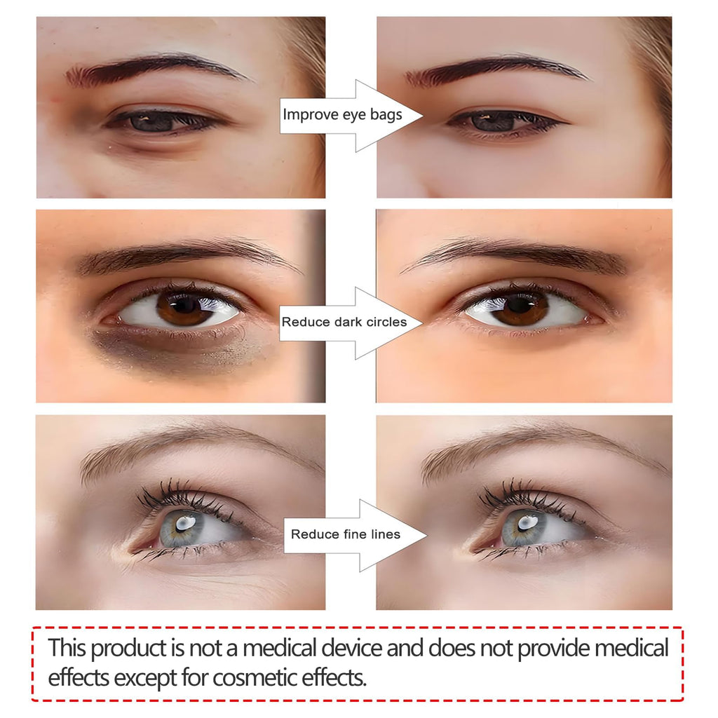 Revitalise Eyes Red Light Therapy Glasses,Microcurrent Eye Beauty Device Botanique Paris under Eye Device Revital Eyes Bag Remover for Reduce Dark Circles Puffiness Wrinkles Relax Eye Strain