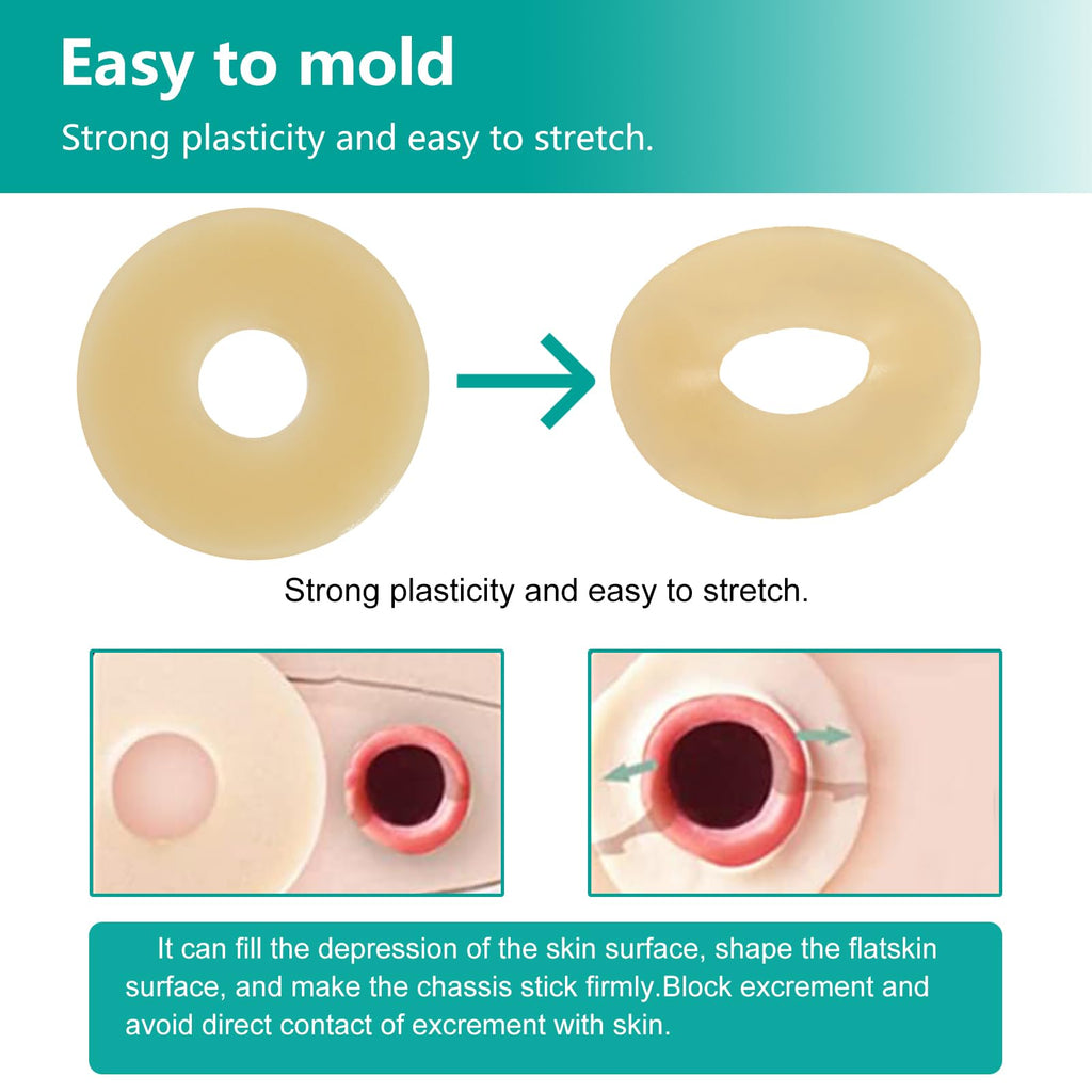 Ostomy Barrier Rings - Outer Diameter 2" (50mm) 2mm Thickness,Moldable Ostomy Rings,Hydrocolloid Skin Extender Rings for Colostomy Bags,10 Count