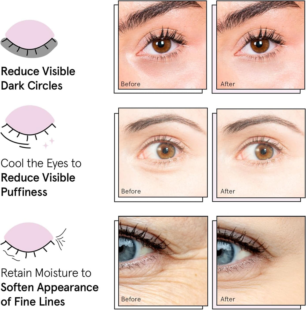 grace & stella Under Eye Patches - Perfect Gifts for Women (12 Pairs)