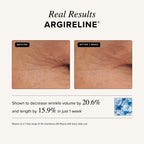 Asterwood Matrixyl 3000 + Argireline Serum for Face - Multi Peptide Serum with Hyaluronic Acid - Anti-Aging, Wrinkle Reducing, Collagen Boosting - Fragrance-Free - 1 Fl Oz