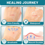 CUKWUYBY Hydrocolloid Roll for Wound Care, 2in*6.6ft Hydrocolloid Bandages