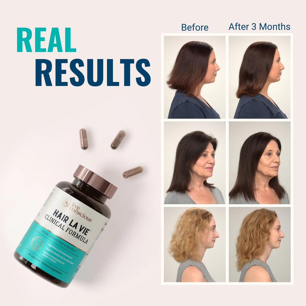 Hair La Vie Live Conscious Clinical Formula Hair Growth Vitamins for Women and Men w/Biotin, Collagen & Saw Palmetto (Pack of 1)