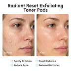 MAREE Glycolic Acid Toner Pads - Face Pads for Exfoliating Peel Zero Pore