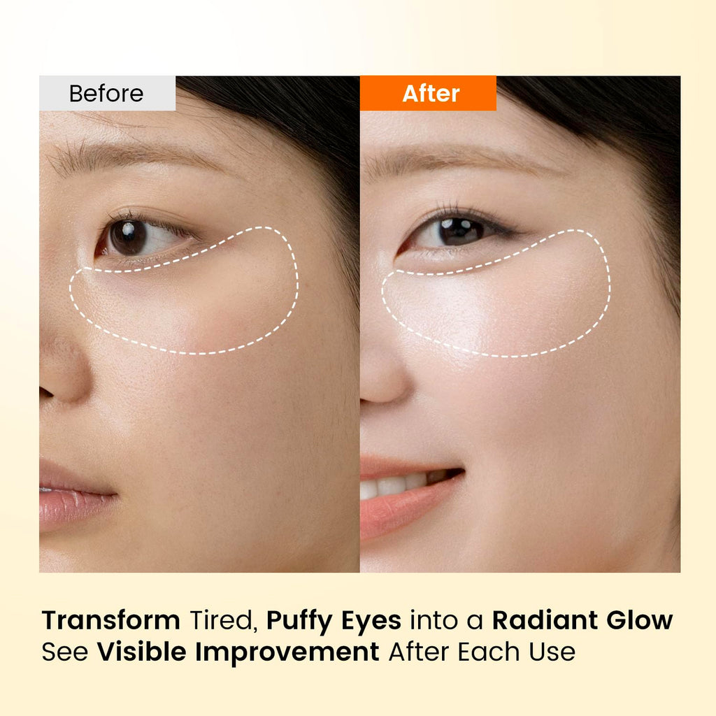 SEONGLOW Caffeine Under Eye Patches: 30 Pairs Korean Hydrogel Eye Masks for Dark Circles Puffiness Relief with Niacinamide Hyaluronic Acid - Undereye Brightening Hydrating Anti-Wrinkle Treatment