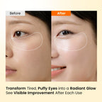 SEONGLOW Caffeine Under Eye Patches: 30 Pairs Korean Hydrogel Eye Masks for Dark Circles Puffiness Relief with Niacinamide Hyaluronic Acid - Undereye Brightening Hydrating Anti-Wrinkle Treatment