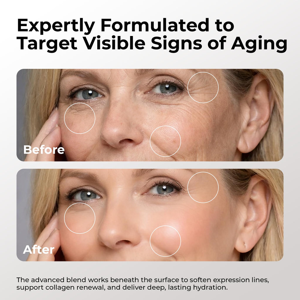 SKIN DEVA 20% Argireline Serum with Matrixyl 3000 Pure Hyaluronic Acid Serum For Face Deep Wrinkle Reducer Anti Aging Tones Skin and Stimulates Collagen Peptides Serum For Face