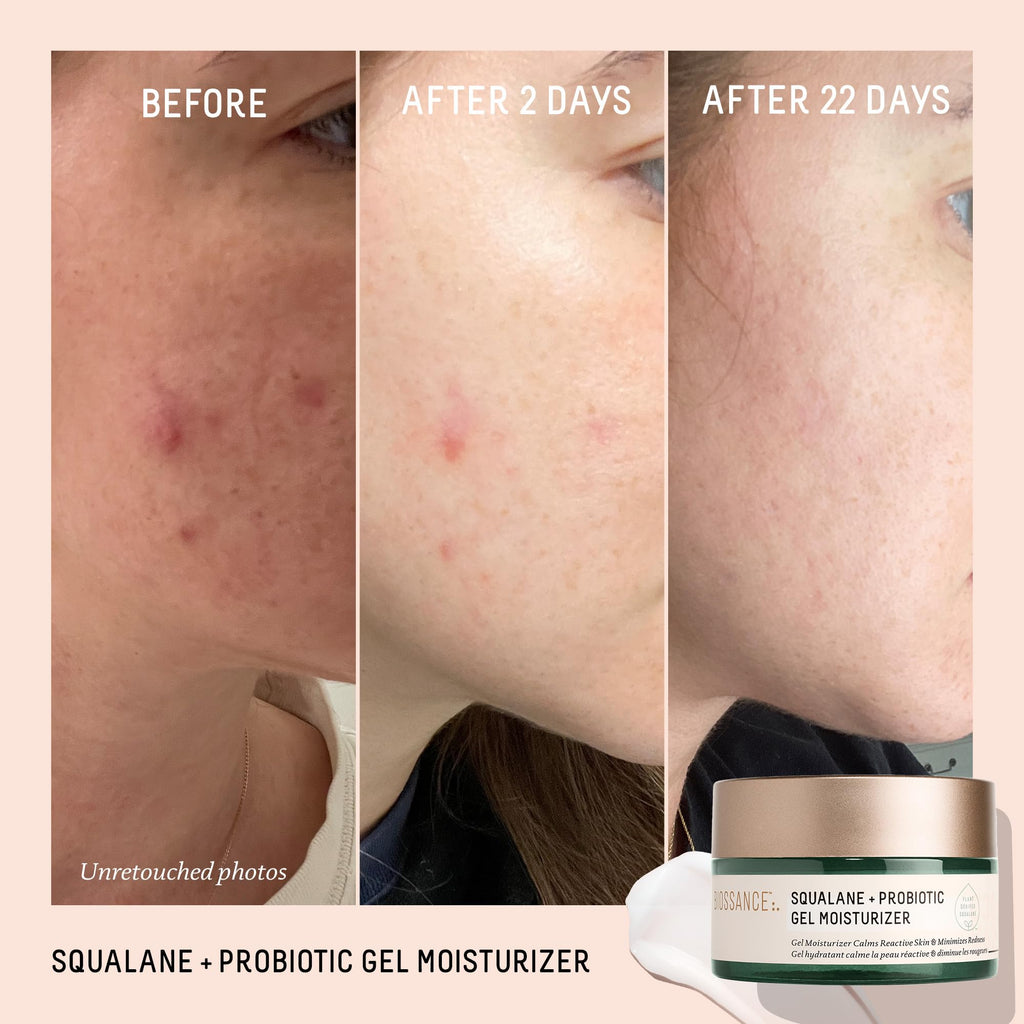 Biossance Squalane + Probiotic Balancing Face Gel Moisturizer - Advanced Formula for Oily & Acne-Prone Skin, Encapsulated Probiotics, Reduces Redness & Excess Oil, Soothes Sensitive Skin - 1.69 oz