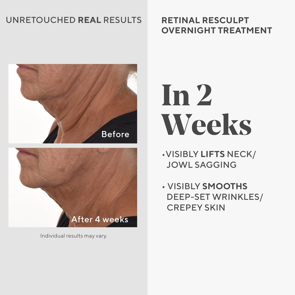 Murad Retinal ReSculpt Overnight Treatment - Advanced Face and Neck Serum with Encapsulated Retinal, Kangaroo Paw, Olive, & Oat Smooths Deep Wrinkles and Crepey Skin, & Lifts Sagging Skin - 1 Fl Oz