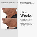 Murad Retinal ReSculpt Overnight Treatment - Advanced Face and Neck Serum with Encapsulated Retinal, Kangaroo Paw, Olive, & Oat Smooths Deep Wrinkles and Crepey Skin, & Lifts Sagging Skin - 1 Fl Oz