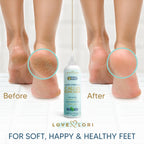 Callus Remover for Feet (Extra Strength) Foot Callus Remover Gel - Pedicure Tools for Feet Scrubber – Foot Care Spa Essentials, 6oz