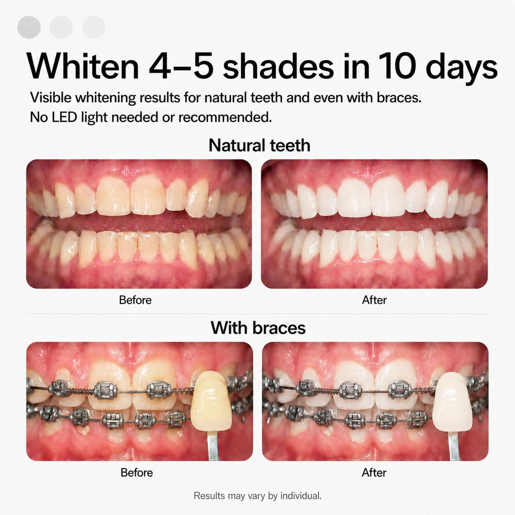 Opalescence GO 15 Whitening Bundle - (7 Treatments) Hydrogen Peroxide Prefilled Teeth Whitening Trays and Travel Original Whitening Toothpaste 1 Oz - Mint Flavor - Includes Toothbrush 6238-1T