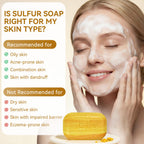 Bee & Flower Shanghai Sulfur Soap 10% Sulfur Soap Bar Face and Body Acne Treatment Sulphur Bar Soaps 3.4 Oz (6 Packs)
