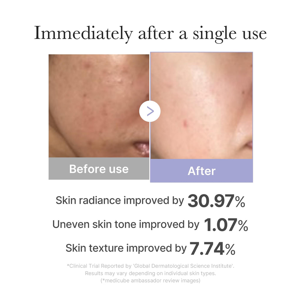 medicube Mini Booster Pro White | Affordable At-Home Facial Skin Care Tool for Beginners - Portable Glow Booster for Glass Skin, Boosting Skin Care Absorption, Skin care for teens, Korean Skin Care