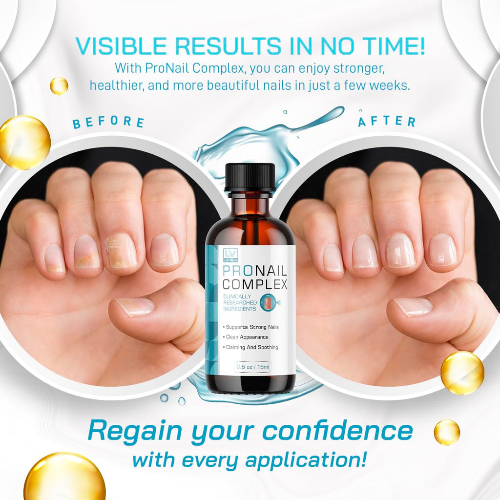 Pronail Complex - Original Formula Toenail Treatment Pronail Complex Liquid Drops Premium Formula Extra Strength, Pro Nail Complex Oil Liquid Drop All Natural Support, 1 Bottle for 1 Month
