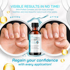 Pronail Complex - Original Formula Toenail Treatment Pronail Complex Liquid Drops Premium Formula Extra Strength, Pro Nail Complex Oil Liquid Drop All Natural Support, 1 Bottle for 1 Month