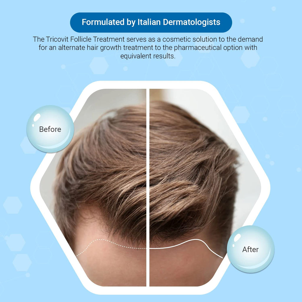 Tricovit Tricocaps Hair Growth Supplement - Hair Loss Treatments for Women & Men Developed by Dermatologists - Contains Amino Acids & Vitamins to Promote Cell Regeneration (60 Softgels)