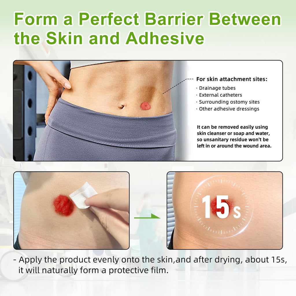 Carbou Skin Barrier Wipes - 100Pcs Skin Prep Wipes - Skin Adhesive Wipes to Create the Barrier Film Between Skin and Attachments, Ostomy Protective Wipes to Increase the Adhesive