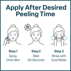 QRxLabs Chemical Peel Neutralizer Spray - Glycolic Acid Peel Neutralizer - pH Balancing Mist for Skin Care - Hydrating Toner for Facial Peels - 2 Fl Oz