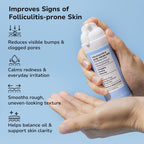 BellamiLuxx Folliculitis Acne Lotion for Body: Helps Reduce Itch, Redness, Body Acne, Bumps & Uneven Texture with Salicylic & Glycolic Acid + Botanicals - Gentle Care for Folliculitis-Prone Skin