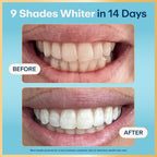 Lumineux Teeth Whitening Strips Kit - 9 Treatments (1 Month) - Peroxide Free - Enamel Safe for Whiter Teeth - Whitening Without The Sensitivity - Dentist Formulated - Sensitivity Free