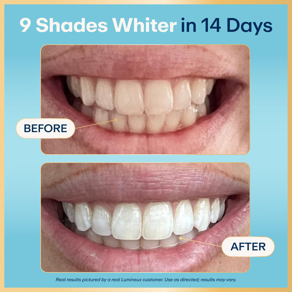 Lumineux Teeth Whitening Strips, Peroxide Free, 21 Treatments (3 Months)