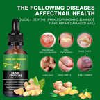 Ginger Toenail Fungus Treatment, Fungal Nail Treatment, Ginger Nail Growth Serum,7 Days Nail Treatment, Antifungal Nail Repair Serum, Fast-Acting Recovery for Thick, Discolored, Yellow Nails