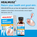 Skin-Tag-Remover, Wart Remover, Mole & Wart-Remover Liquid, Fast-Acting Skin-Tag-Remover for Tag Removal & Verruca-Treatment