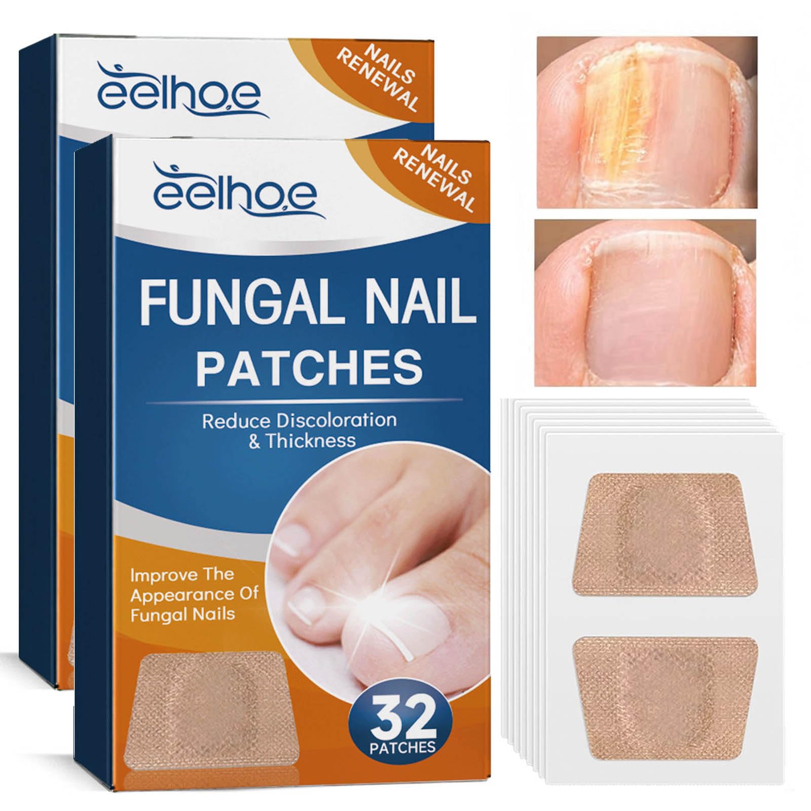 64PCS Fungal Nail Patches, Fungal Nail Treatment for Toenails Extra Strong, Fast-Acting Nail Fungal Treatment Patches for Damaged & Thick Nails, Overnight Repair & Long-Lasting Relief