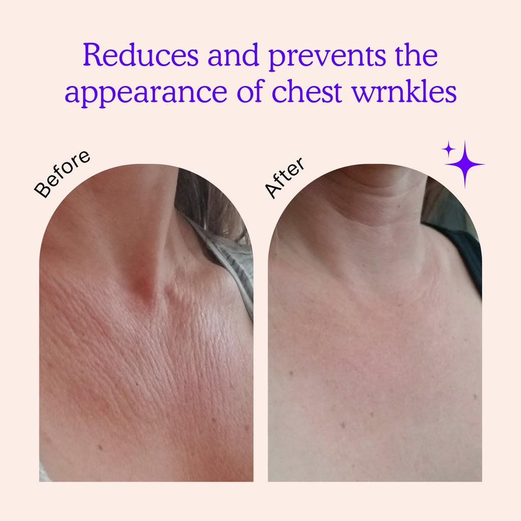 BLUMBODY Chest Wrinkle Pads – Anti-Wrinkle Silicone Patches Skin Firming, Smoothing – Reusable Overnight Chest Pads – Anti-Aging Crepe Erase Pad – Neck, Décolleté (1-Month Supply)