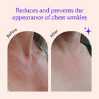 BLUMBODY Chest Wrinkle Pads – Anti-Wrinkle Silicone Patches Skin Firming, Smoothing – Reusable Overnight Chest Pads – Anti-Aging Crepe Erase Pad – Neck, Décolleté (1-Month Supply)
