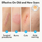 Serica Scar Gel (1oz), Advanced Silicone Formula, Supports Visibly Smoother-Looking Skin After Surgery, Cuts, Burns or Acne, Non-Comedogenic Face-Safe Gel, Helps Reduce Dryness, Quick-Dry