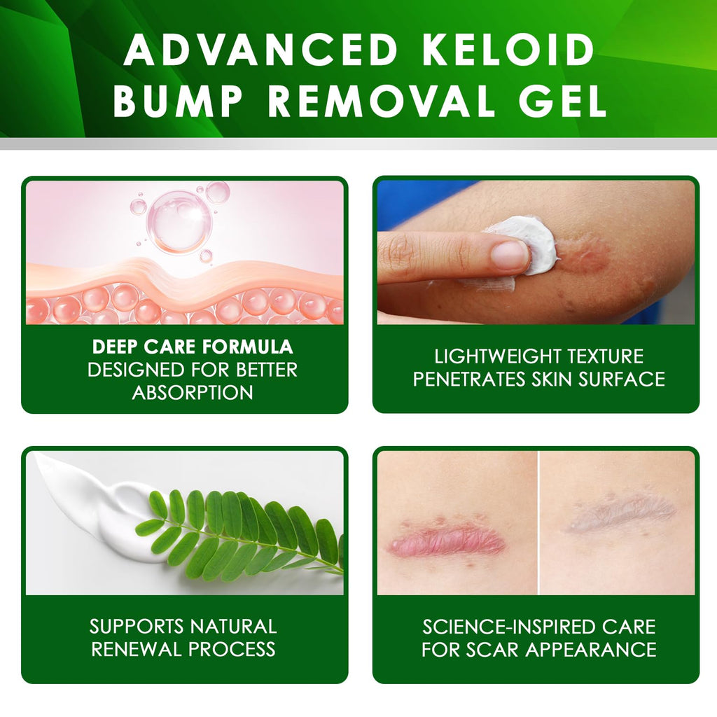 Tobcharm Advanced Keloid Scar Care Gel, Silicone Gel for Appearance of Keloid Scars & Skin Marks, Scar Smoothing Gel for Ears, Face & Body, 2-Pack (2×30g)