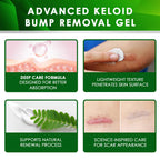 Tobcharm Advanced Keloid Scar Care Gel, Silicone Gel for Appearance of Keloid Scars & Skin Marks, Scar Smoothing Gel for Ears, Face & Body, 2-Pack (2×30g)