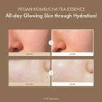 Dr.Ceuracle Vegan Kombucha Tea Essence - Hydrating Milky Toner with Kombucha Tea Extract, Centella Asiatica, Ceramide, Korean Skincare Essence (150 ml / 5.07 fl. oz.)