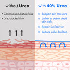 Ebanel Urea Cream 40% plus Salicylic Acid 2%, Foot Cream for Dry Cracked Heels Feet Knees Elbows Hands, Foot Dead Skin Cuticle Callus Remover Toenail Softener, Keratolytic Skin Barrier Repair