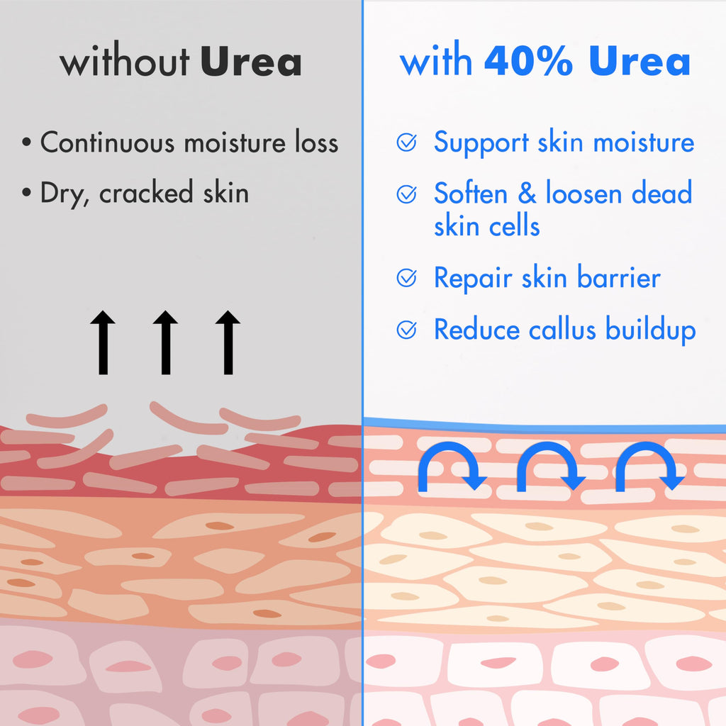 Ebanel Urea Cream 40% plus Salicylic Acid 2%, Foot Cream for Dry Cracked Heels Feet Knees Elbows Hands, Foot Dead Skin Cuticle Callus Remover Toenail Softener, Keratolytic Skin Barrier Repair, 6-Pack