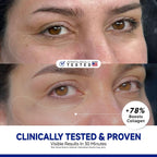 Dr Vincent Peptide Under Eye Patches, Firming Eye Patches Instant Reduces Dark Circles and Puffiness, Collagen Under Eye Mask for Bags Treatment, Wrinkles, 24 Pairs, Vegan