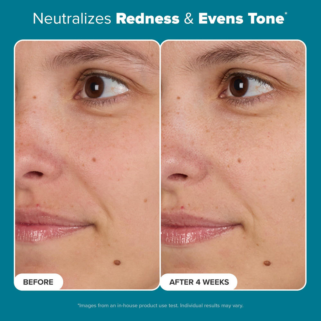 Paula's Choice Skin Balancing Pore-Reducing Face Toner with Niacinamide, for Oily Skin & Combination, Minimizes Large Pores, Controls Oil & Shine, Hydrates & Replenishes, Fragrance-Free, 6.4oz